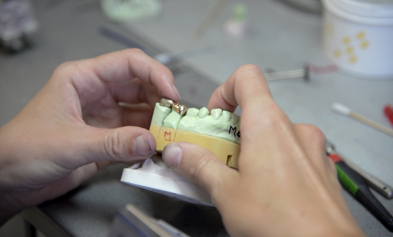 crowns in lab dental crowns