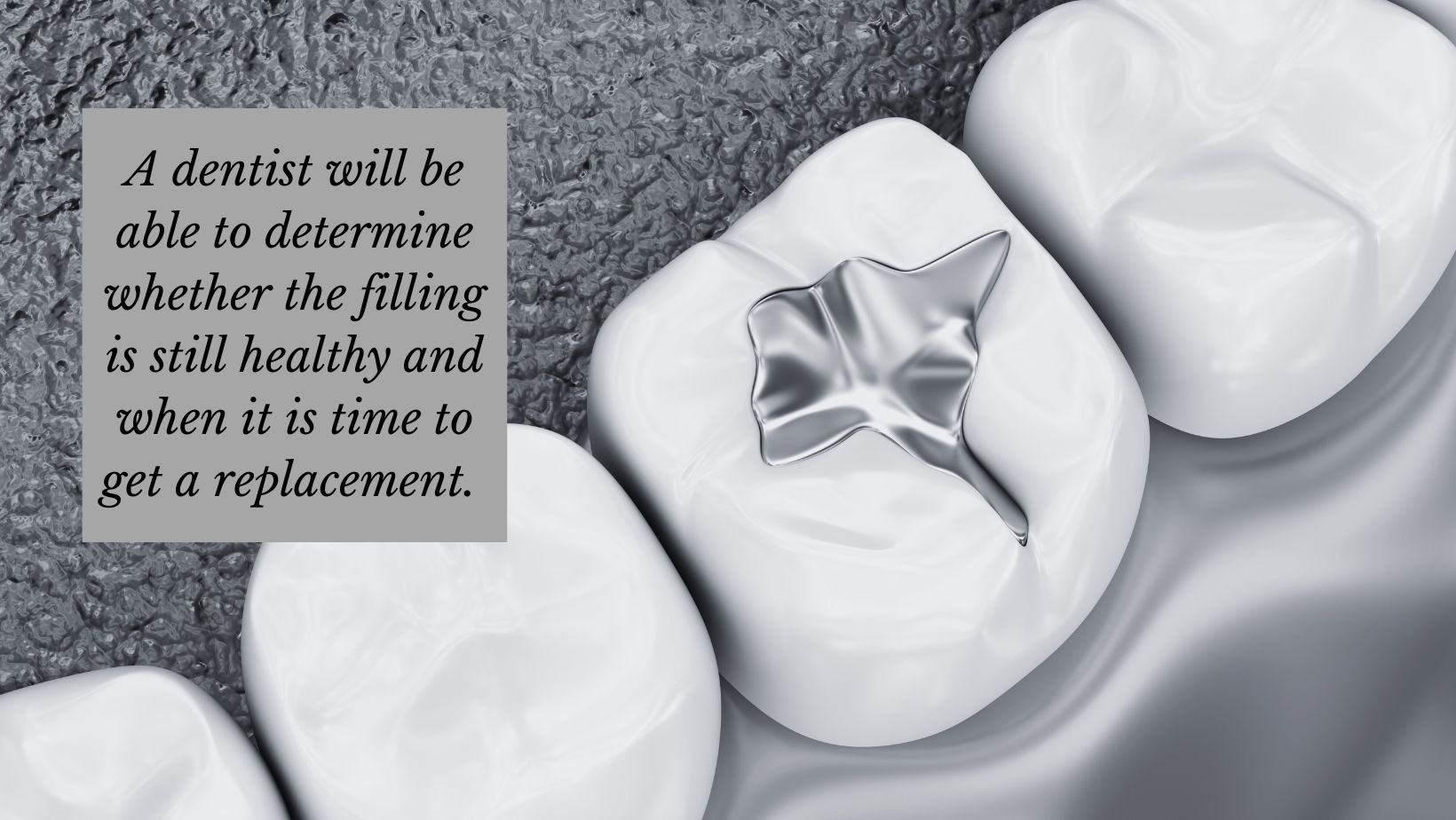 dental filling