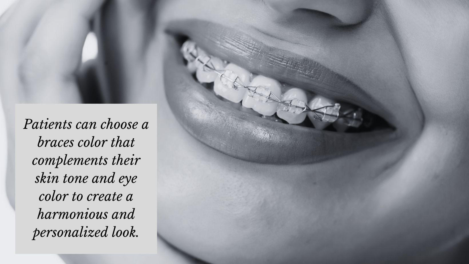 dental patient considering color of braces