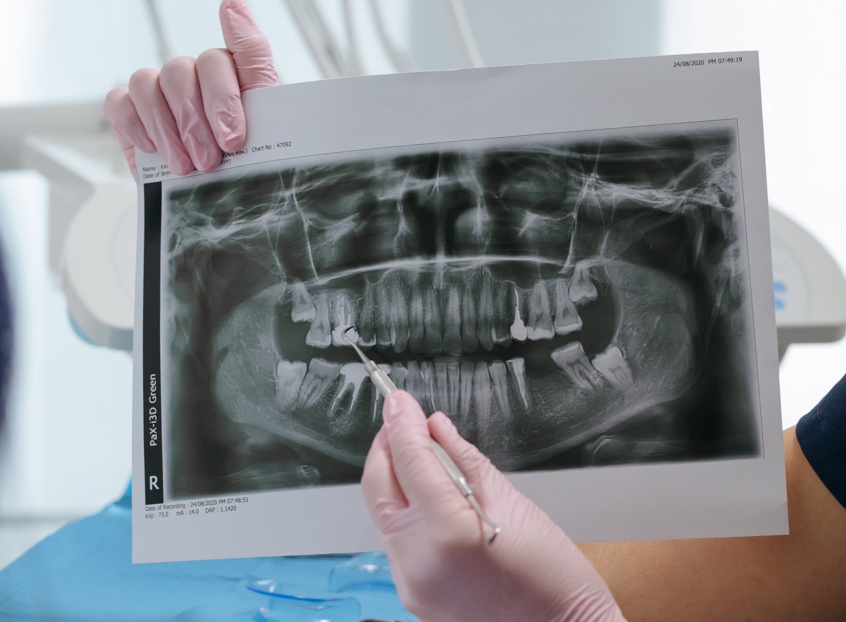 Dentist pointing out results of dental x-ray