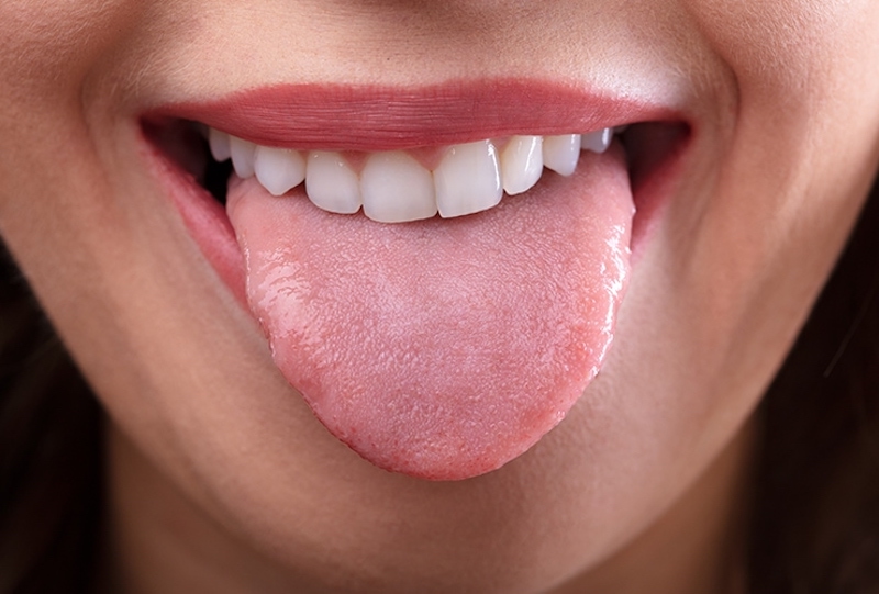 Woman smiling, showing dental crowns