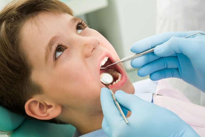 Should You Put Sealants on Baby Teeth?