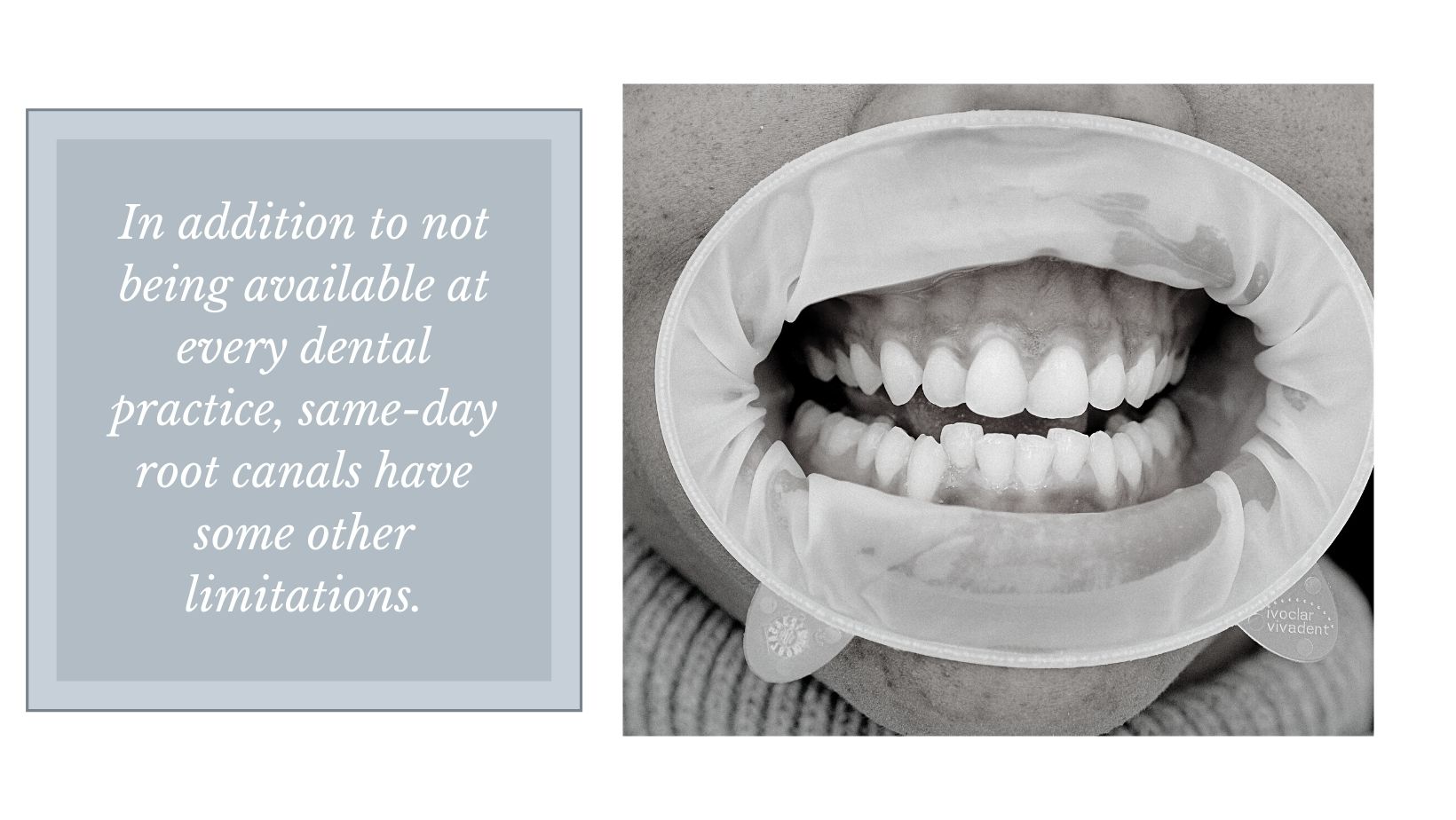 oral dam on patient for tooth restoration or root canal