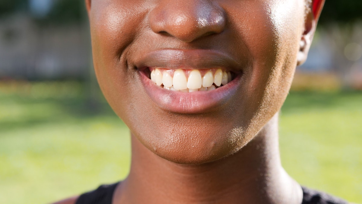 What is Carbamide Peroxide Teeth Whitening?