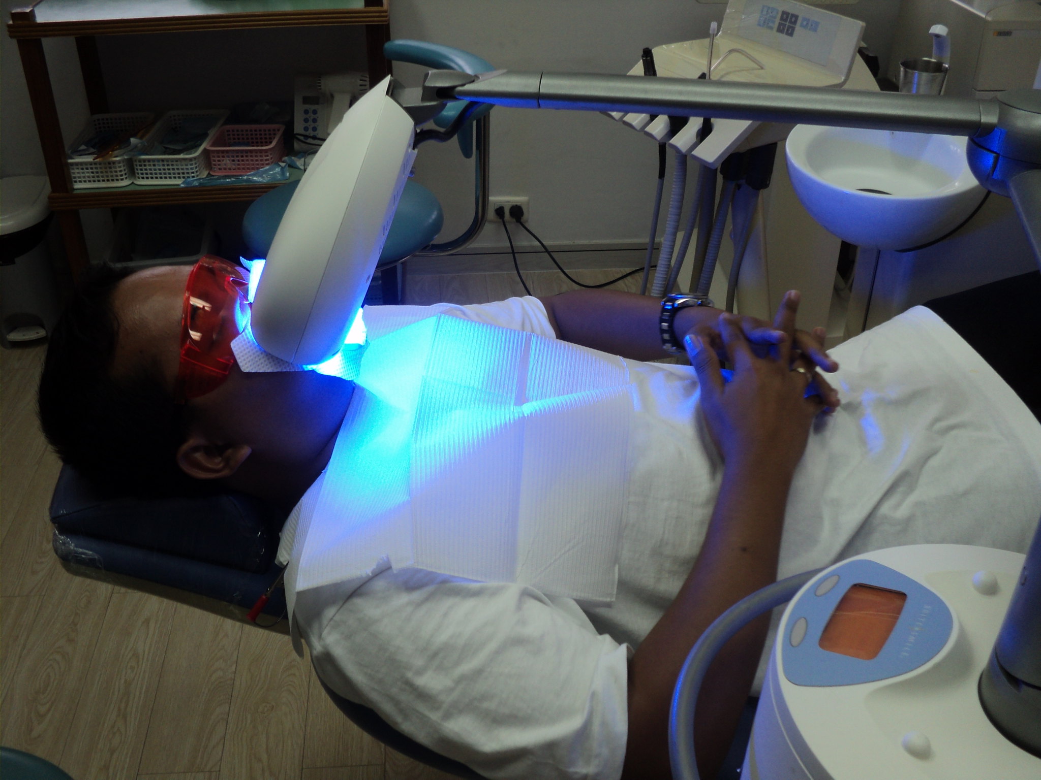 teeth whitening with xoom